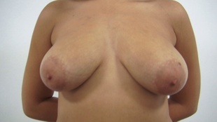 2. Download full pics of Erika (20) from czechcasting.com