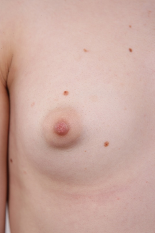 5. Download full pics of Andrea (18) from czechcasting.com