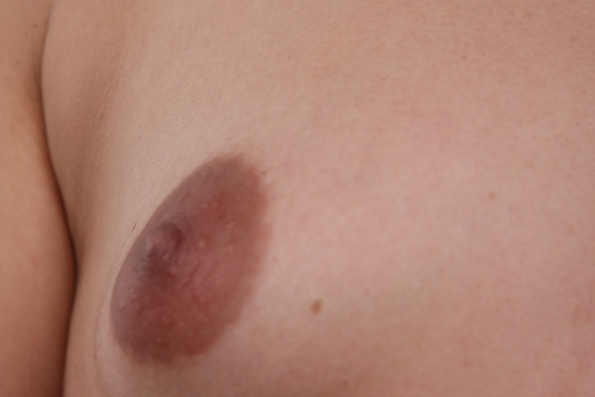 breast,areola,torso,skin texture,mole,natural lighting,close-up,pale skin