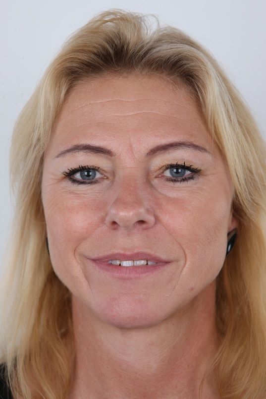 1. Download full pics of Zdenka (52) from czechcasting.com