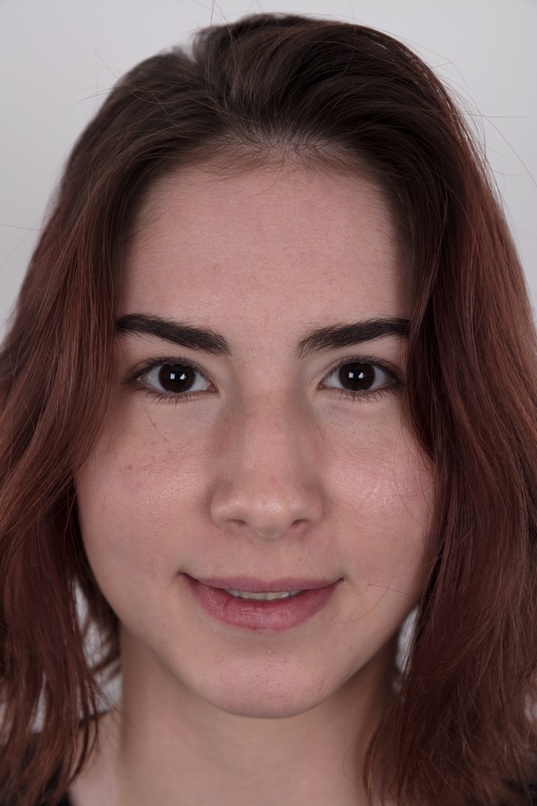 brunette,white skin,slim,face closeup,headshot,pigment spots,no makeup,amateur
