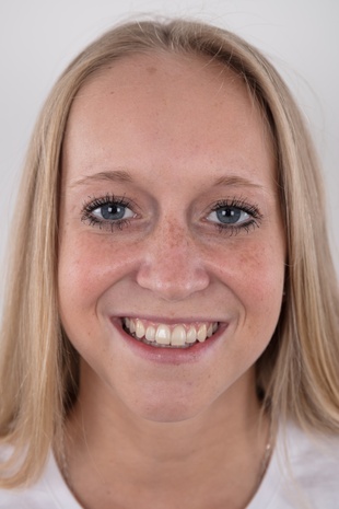 1. Download full pics of model Stepanka (20) from czechcasting.com