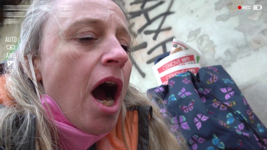 1. Download full pics of 10 000 USD Prolapsus vaginal from goperv.com