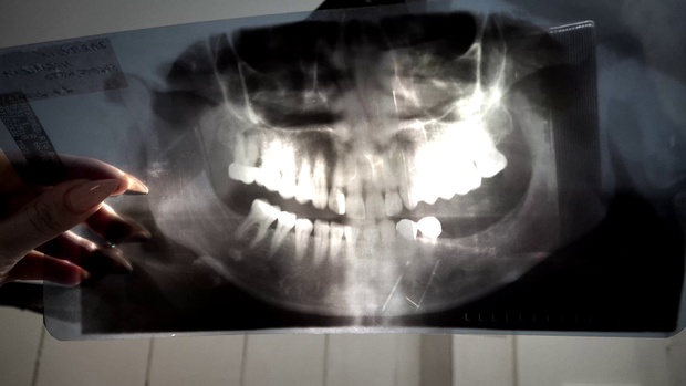 1. Download full pics of Dentist from nudz.com