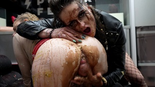 11. Download full pics of Shower for Vaginal Prolapse from goperv.com