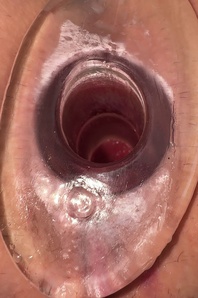 3. Download full pics of Opened Anal 🥵 from selfiefetish.com