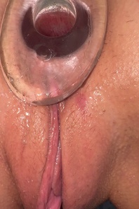 6. Download full pics of Opened Anal 🥵 from selfiefetish.com