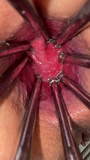 3. Download full pics of Metal spider claws, smiling face, and my hole open 🩺 from goperv.com