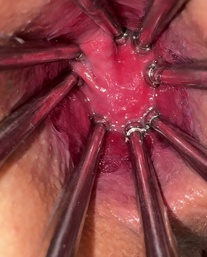 Selfie Fetish: Metal spider claws, smiling face, and my hole open 🩺