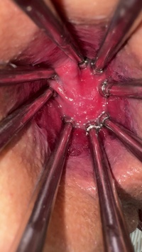 Selfie Fetish: Metal spider claws, smiling face, and my hole open 🩺