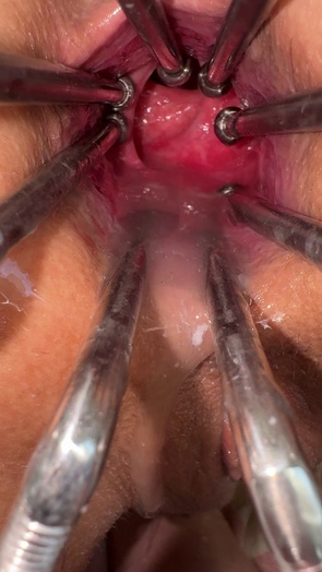 1. Download full pics of Shiny hooks in my pussy, and i’m still smiling 🩺 from goperv.com