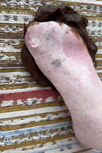 pink sock in my shit. don't pretend you won't stare