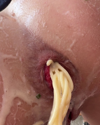 Spaghetti out, prolapse showing, no shame 🐷